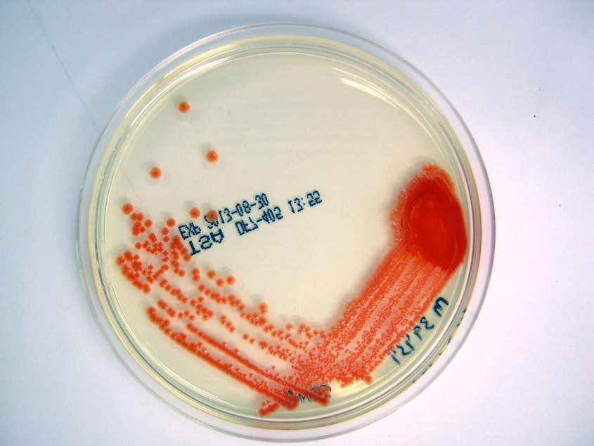 caption: Serratia marcescens bacteria in a petrie dish.