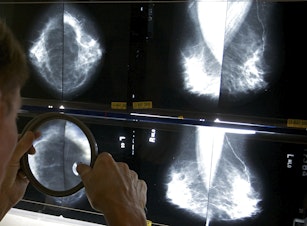 caption: A radiologist uses a magnifying glass to check mammograms for breast cancer in Los Angeles, May 6, 2010. An influential U.S. task force now says women should get screened for breast cancer every other year starting at age 40. The U.S. Preventive Services Task Force announced the updated guidance Tuesday, April 30, 2024.