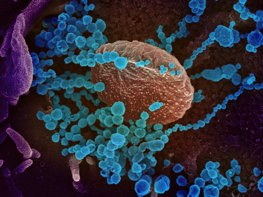 caption: A colorized scanning-electron-microscope image shows SARS-CoV-2 (the round blue objects) emerging from cells cultured in the lab. SARS-CoV-2 is the coronavirus that causes the disease COVID-19.