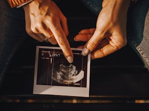 caption: The medical community dates pregnancy to the first day of a woman's last period, even though fertilization generally happens two weeks after that. It's a long-standing practice but a confusing one.