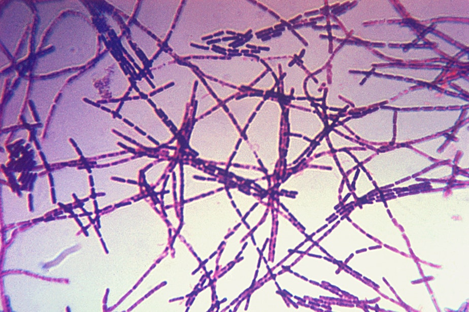 caption: A photomicrograph of Bacillus anthracis bacteria using Gram-stain technique.