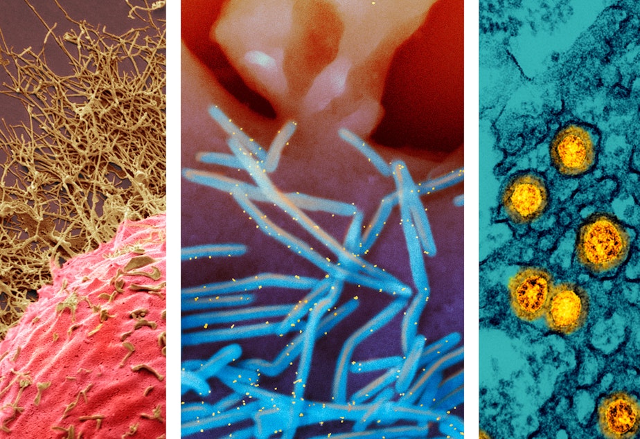caption: From left: 1) Colored scanning electron micrograph (SEM) of a human cell infected with H3N2 flu virus (gold filamentous particles). 2) Scanning electron micrograph of human respiratory syncytial virus (RSV) virions (colorized blue) that are shedding from the surface of human lung epithelial cells. 3) Transmission electron micrograph of SARS-CoV-2 Omicron virus particles (gold).