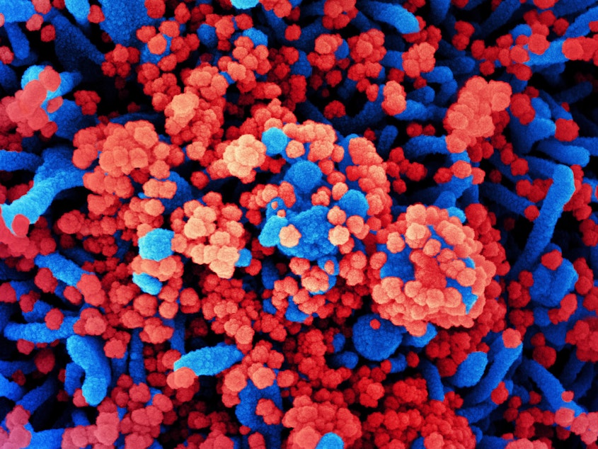 caption: SARS-CoV-2 virus particles, shown in red, have heavily infected a cell in this colorized scanning electron micrograph.