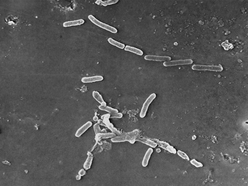 caption: This scanning electron microscope image made available by the Centers for Disease Control and Prevention shows rod-shaped Pseudomonas aeruginosa bacteria. U.S. health officials are advising people to stop using the over-the-counter eye drops, EzriCare Artificial Tears, that have been linked to an outbreak of drug-resistant infections of Pseudomonas aeruginosa.