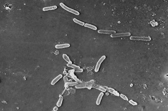caption: This scanning electron microscope image made available by the Centers for Disease Control and Prevention shows rod-shaped Pseudomonas aeruginosa bacteria. U.S. health officials are advising people to stop using the over-the-counter eye drops, EzriCare Artificial Tears, that have been linked to an outbreak of drug-resistant infections of Pseudomonas aeruginosa.